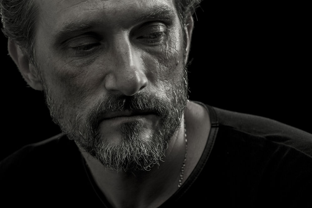 Man showing physical effects of methamphetamine use 